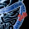 Healthy Savings - Impact of Colorectal Cancer